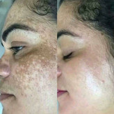 صابون چند کاره بیوممتیک دست و صورت زردچوبه دکتربیز برای رفع تیرگی -رفع لک و اکنه -درمان جوش-شفافیت-رطوبت رسان پک سه عددی