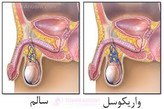 معجون واریکوسل وارداتی/طب سنتی هندی ایرانی با ده گرم ژل رویال