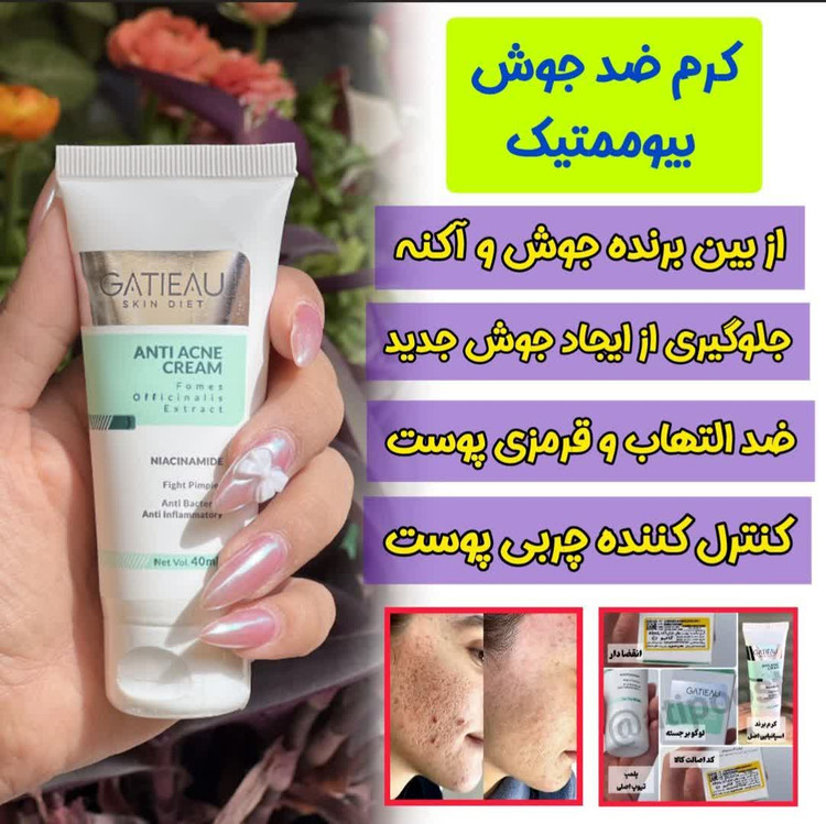 کرم بیوممتیک ضد لک 4 کاره گاتیو ایتالیا 40میل اصلی